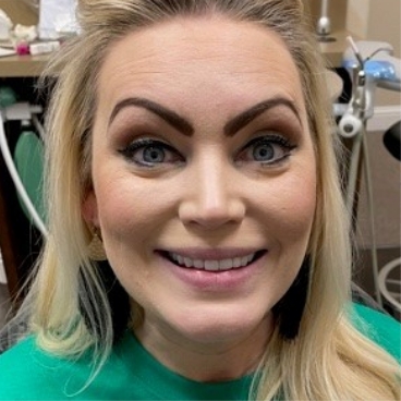 Woman smiling after cosmetic dentistry